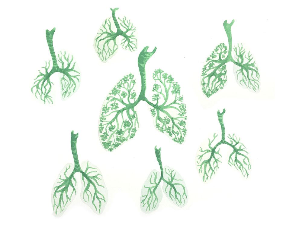 LungTreesDW.jpg
