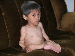image atom