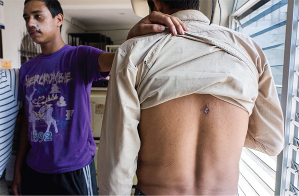 Escobal mine protesters show wounds