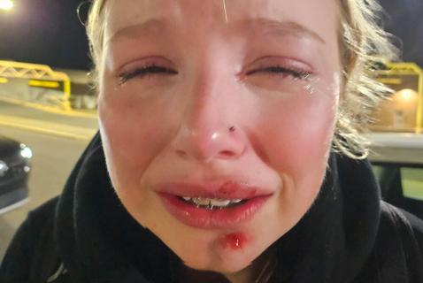 Questions Abound in Violent Edmonton Police Takedown of Teen Girl