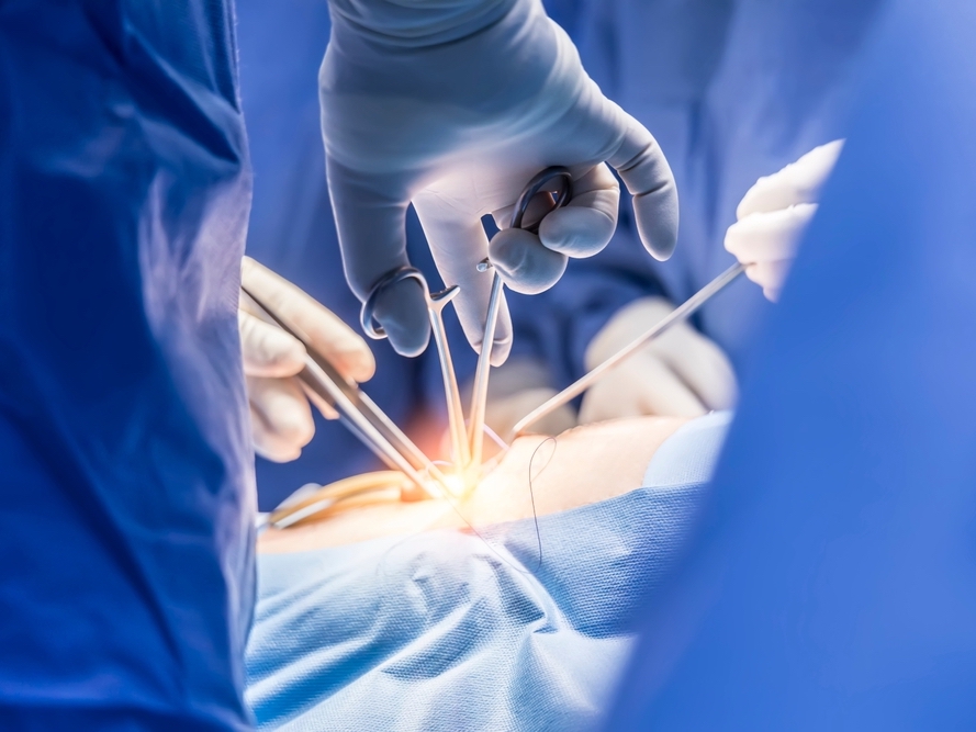 View of a surgeon's gloved hands holding instruments, operating on a patient.