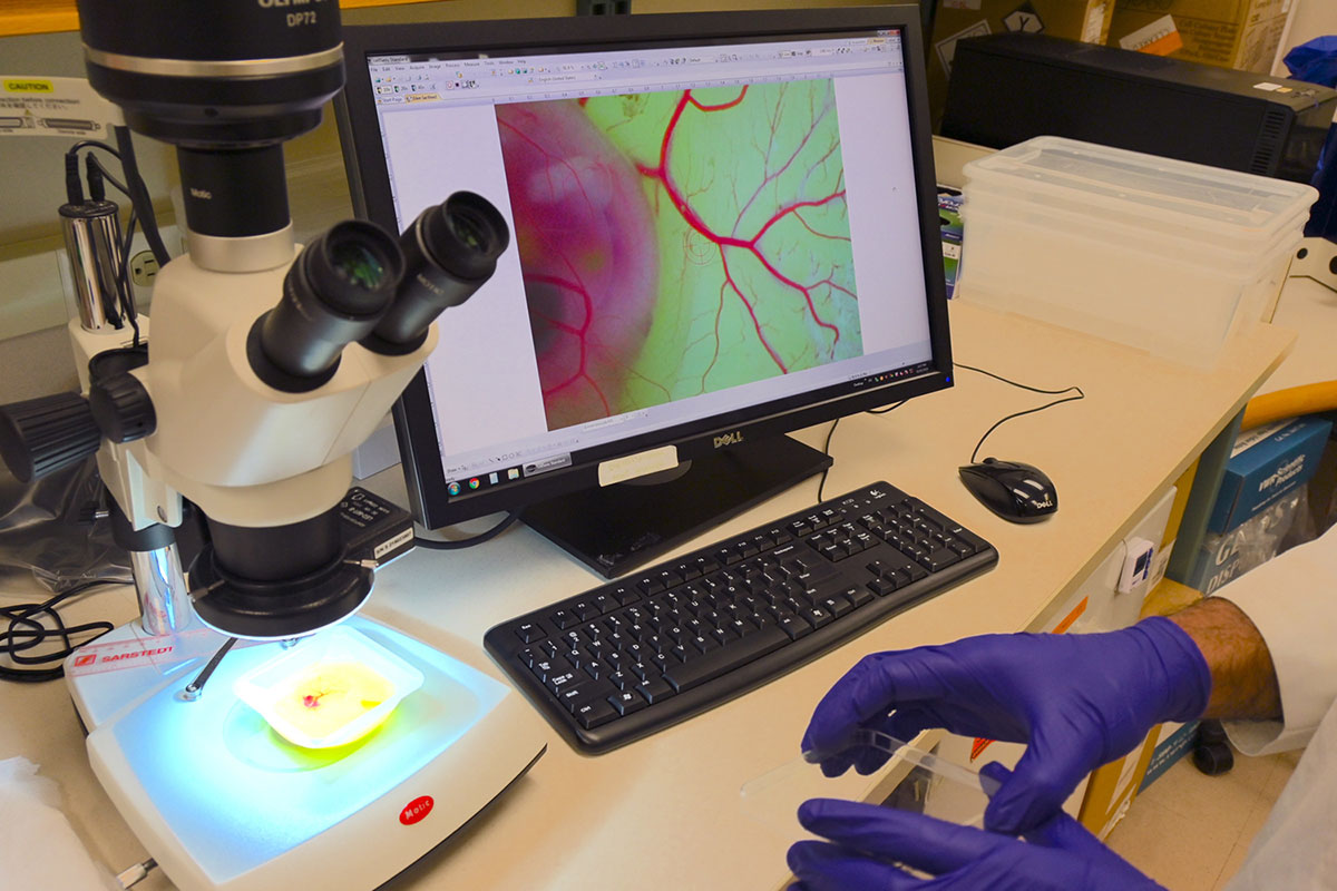 A fertilized egg sits under a microscope in a dish. On a computer adjacent to it, veins spiderweb out from a pink mass.