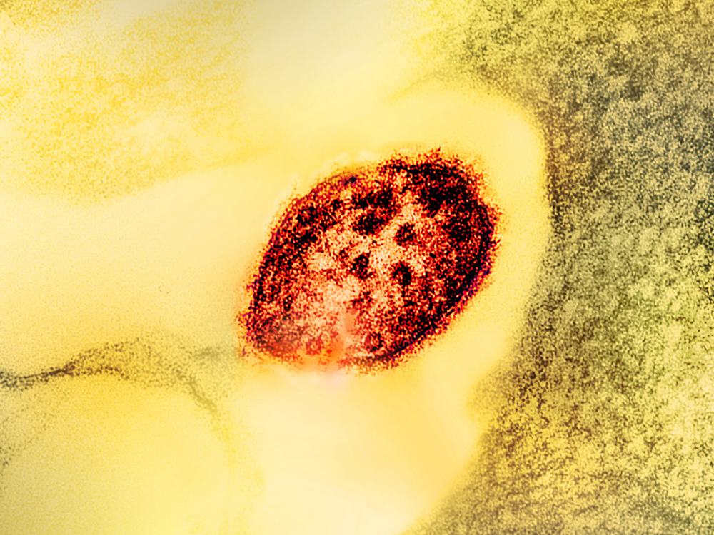 A microscopic view of a red oval-shaped measles virus particle.