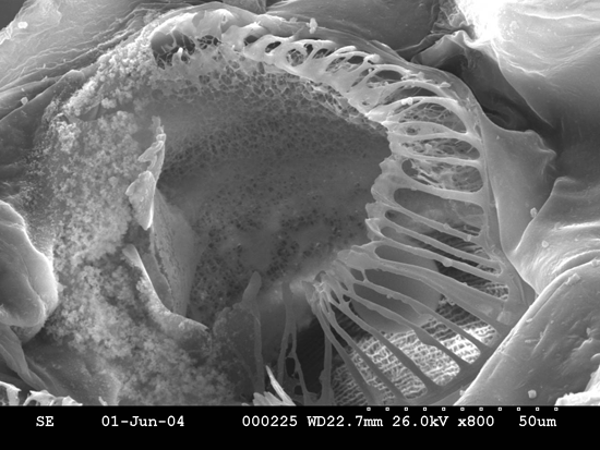 mosquito10
